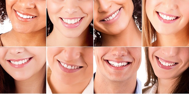 Teeth Whitening Gets Rid of Spots | Burke, VA