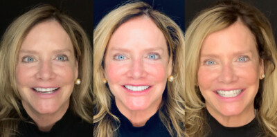 reconstructing smiles