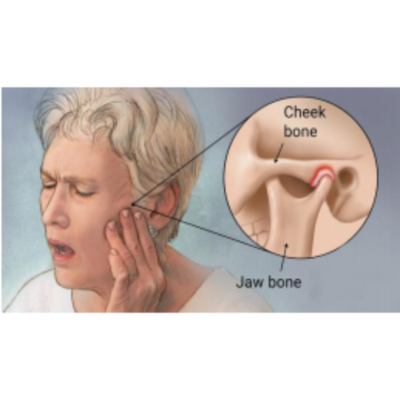 avoid tmj pain