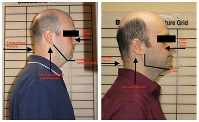 Controlled Arch Orthodontics